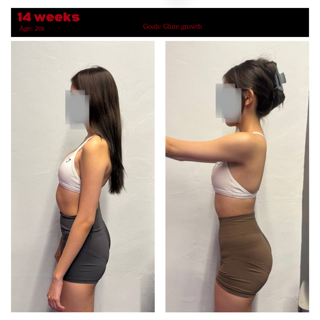 E. Kwan transformation